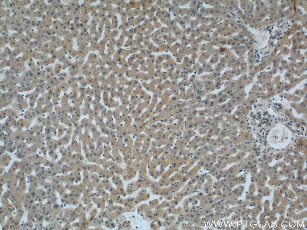 Immunohistochemistry (IHC) staining of human liver tissue using C1qC Polyclonal antibody (16889-1-AP)