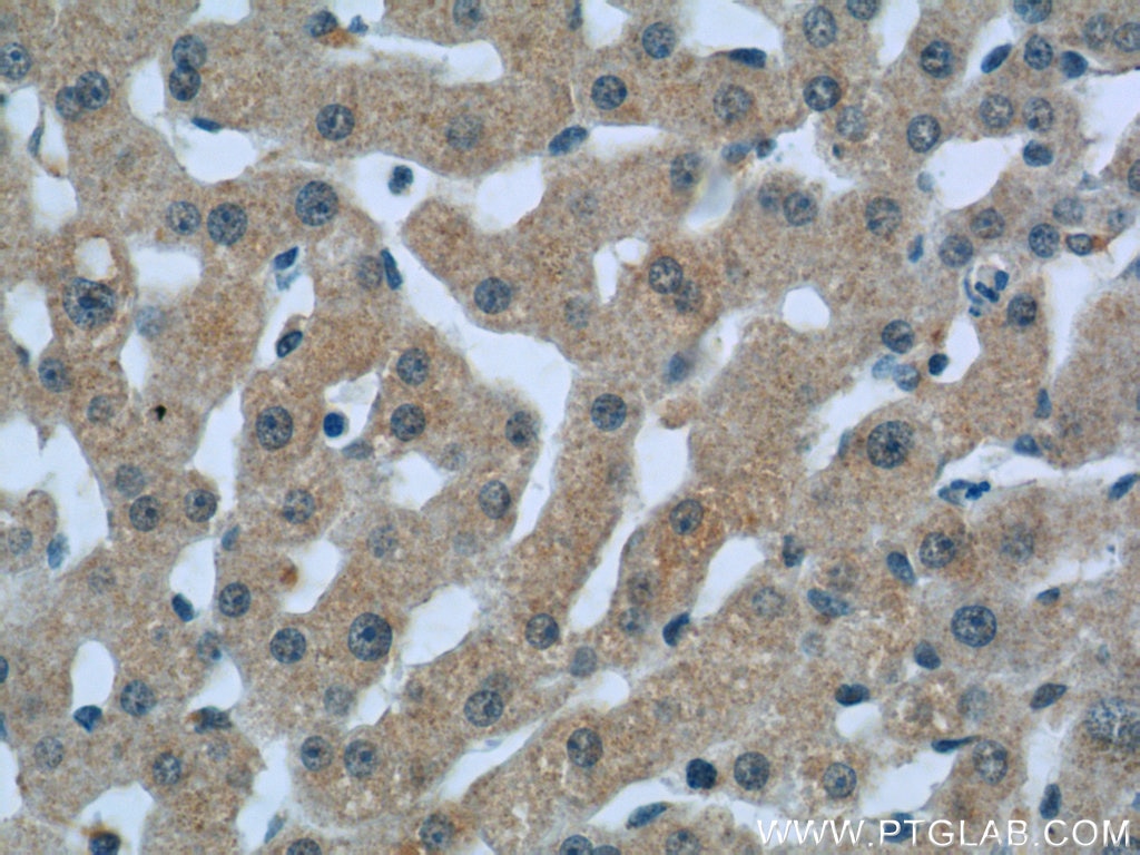 IHC staining of human liver using 16889-1-AP