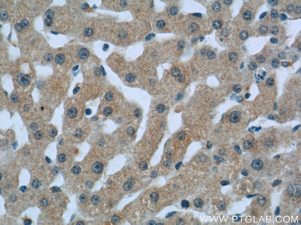 Immunohistochemistry (IHC) staining of human liver tissue using C1qC Polyclonal antibody (16889-1-AP)