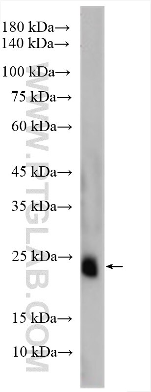 Western Blot (WB) analysis of mouse serum using C1qC Polyclonal antibody (16889-1-AP)