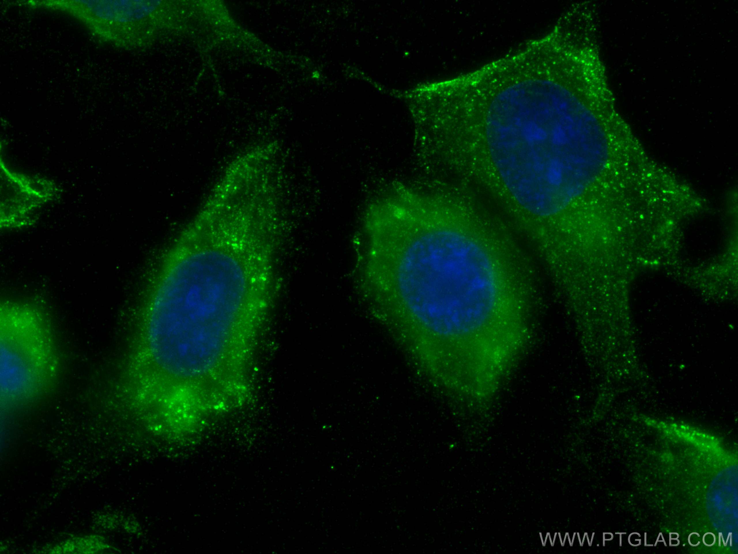 Immunofluorescence (IF) / fluorescent staining of HUVEC cells using C1qC Monoclonal antibody (66268-1-Ig)