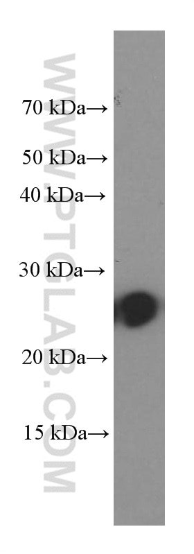 Western Blot (WB) analysis of human plasma using C1qC Monoclonal antibody (66268-1-Ig)