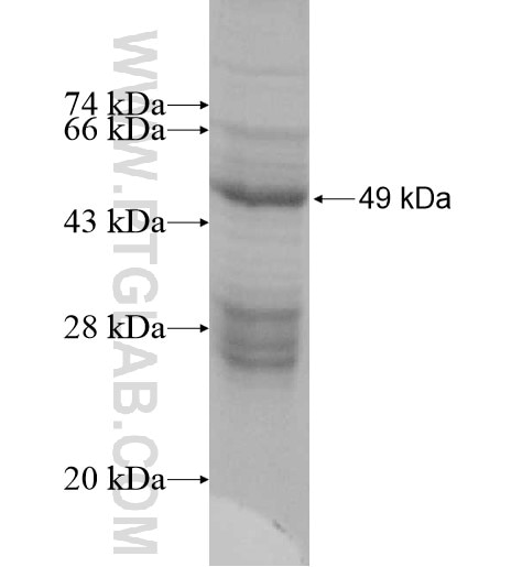 C1QC fusion protein Ag10400 SDS-PAGE