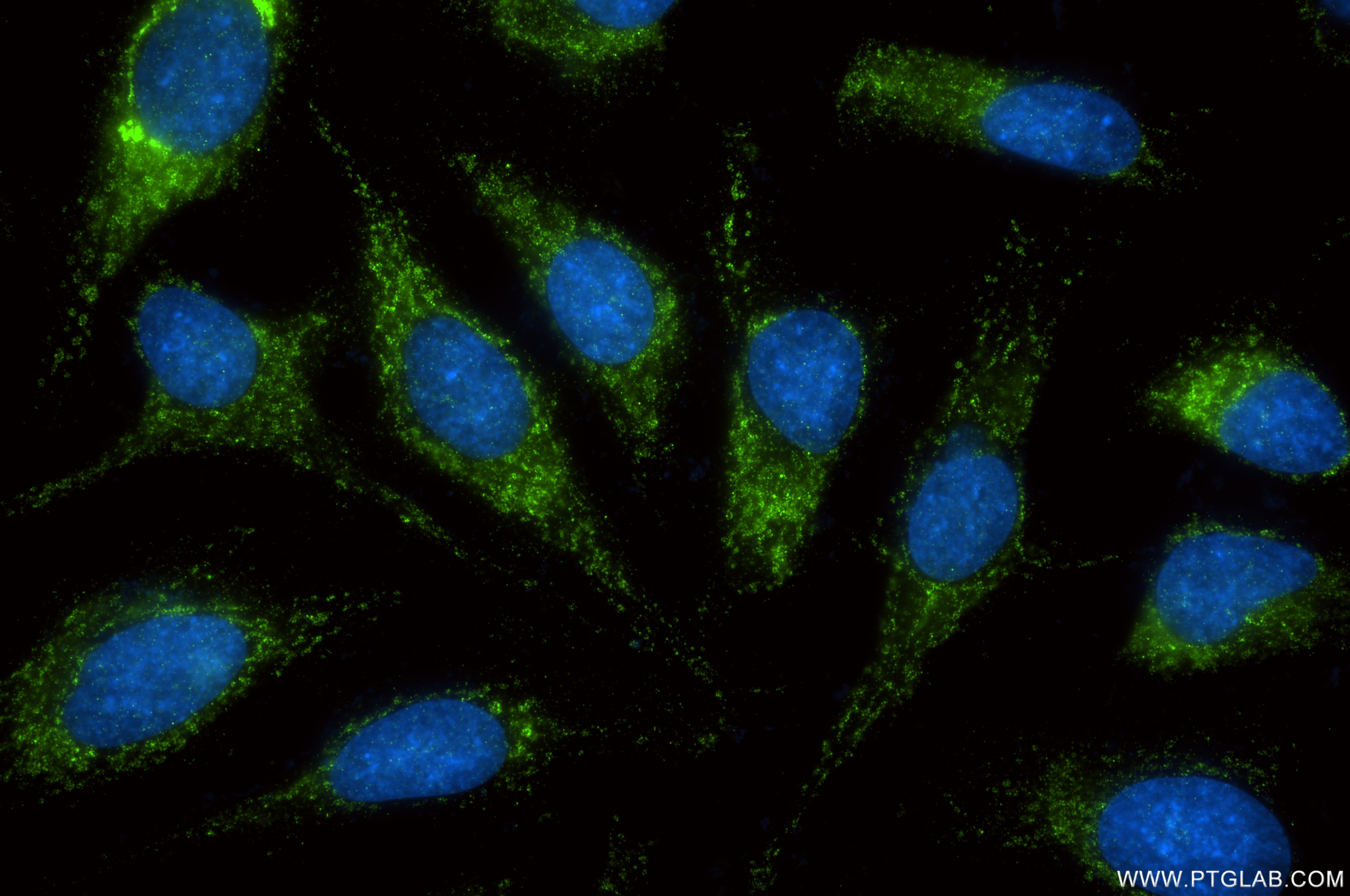 IF Staining of HeLa using 87797-1-RR Immunofluorescence (IF) / fluorescent staining of HeLa cells using C1QL2 Recombinant monoclonal antibody (87797-1-RR)