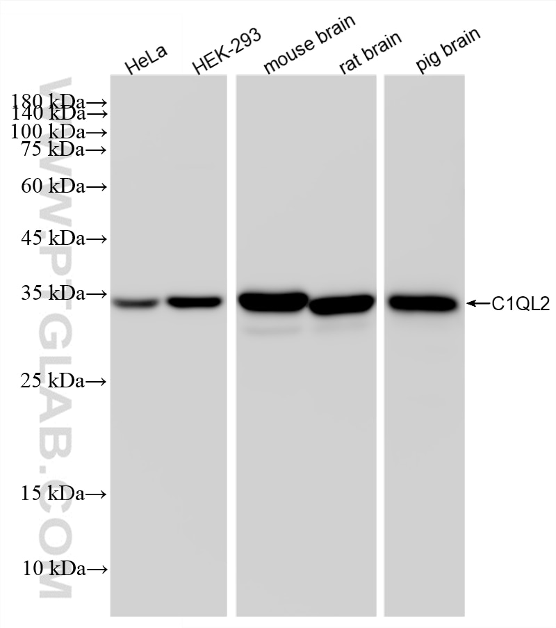 WB analysis using 87797-1-RR Western Blot (WB) analysis of various lysates using C1QL2 Recombinant monoclonal antibody (87797-1-RR)