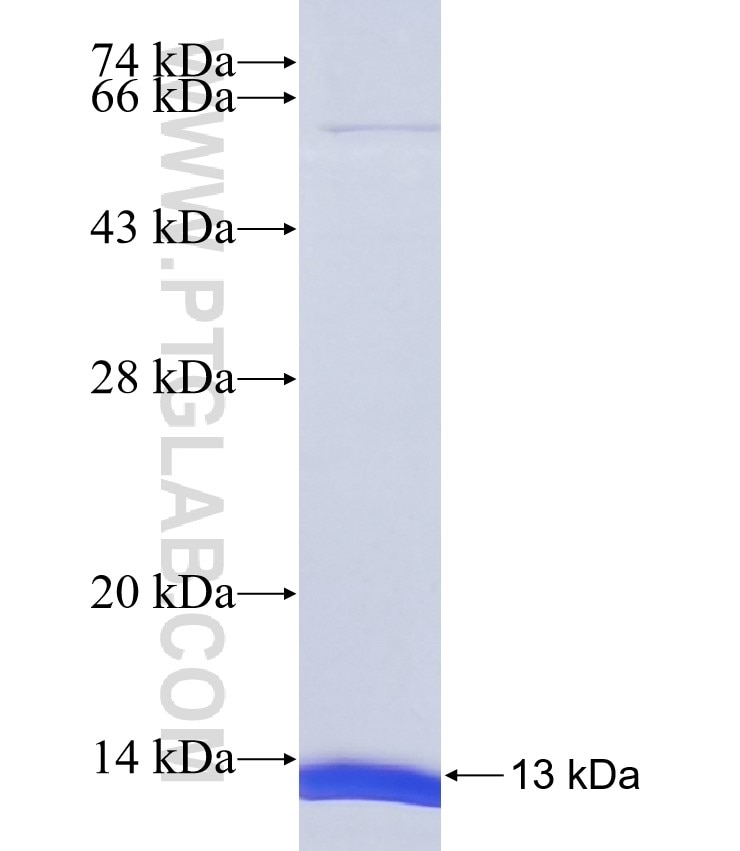 C1QL3 fusion protein Ag37421 SDS-PAGE C1QL3 fusion protein Ag37421 SDS-PAGE