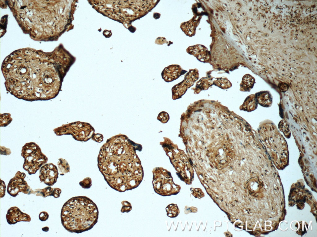 Immunohistochemistry (IHC) staining of human placenta tissue using CTRP1 Polyclonal antibody (12209-1-AP)