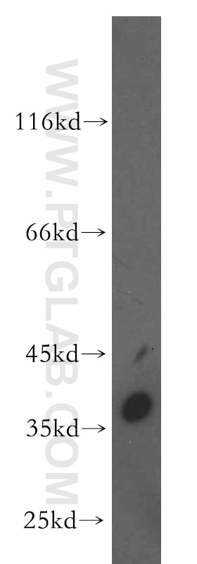 Western Blot (WB) analysis of human testis tissue using CTRP1 Polyclonal antibody (12209-1-AP)