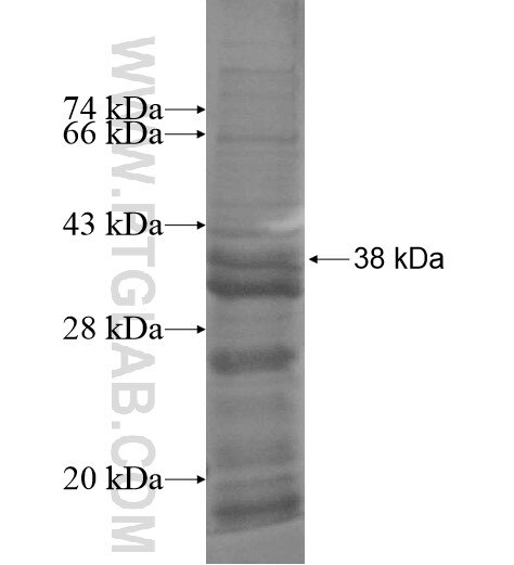 C1QTNF1 fusion protein Ag14435 SDS-PAGE