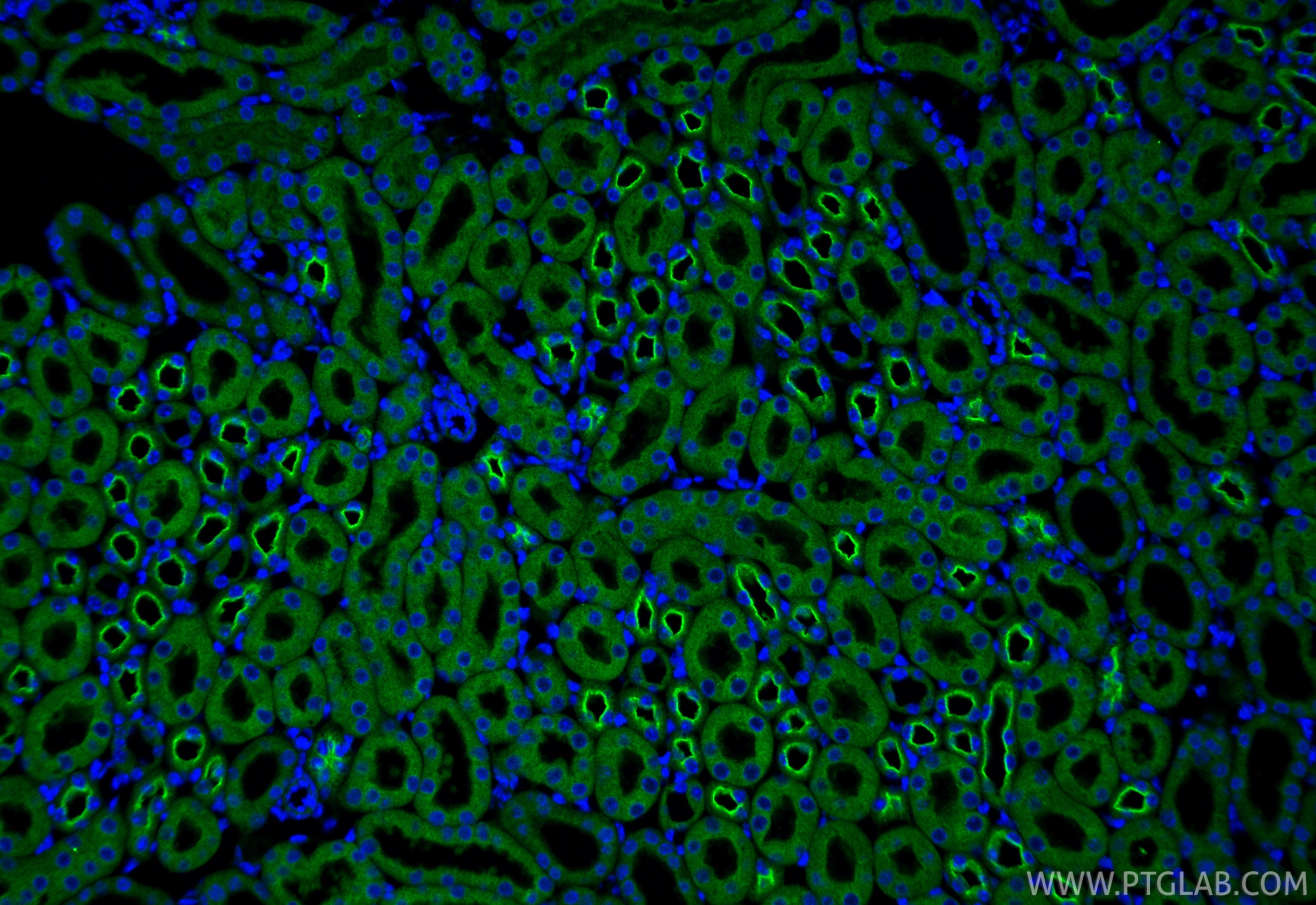 Immunofluorescence (IF) / fluorescent staining of mouse kidney tissue using C1QTNF3 Polyclonal antibody (11414-1-AP)