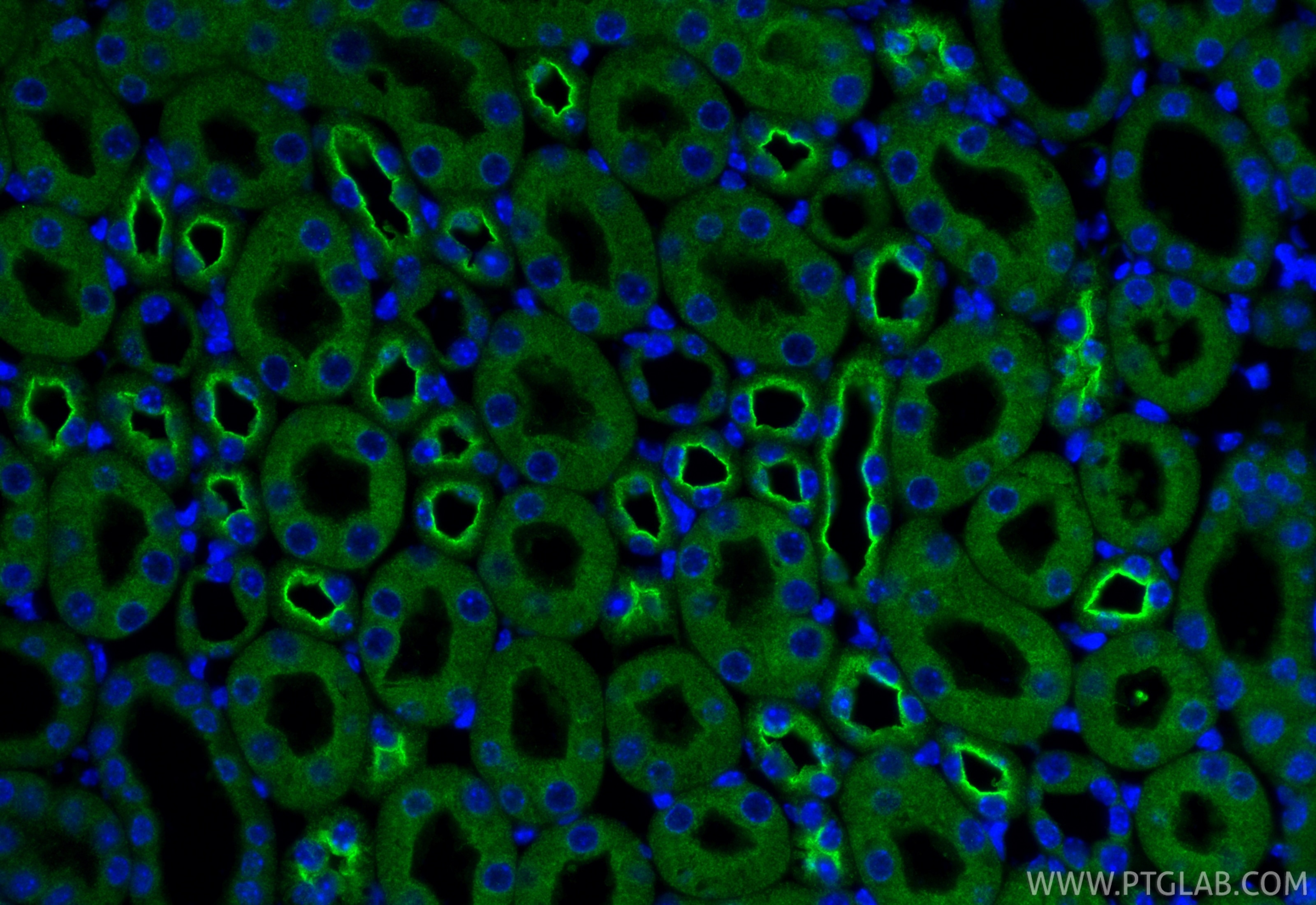 Immunofluorescence (IF) / fluorescent staining of mouse kidney tissue using C1QTNF3 Polyclonal antibody (11414-1-AP)