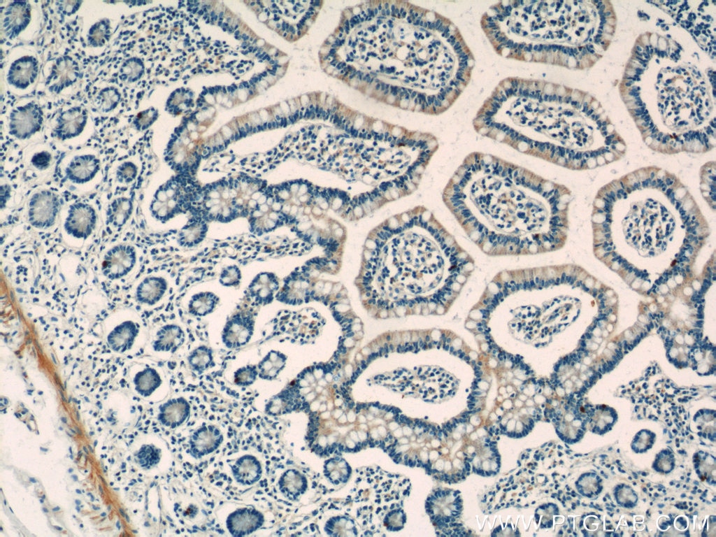Immunohistochemistry (IHC) staining of human small intestine tissue using C1QTNF3 Polyclonal antibody (11414-1-AP)
