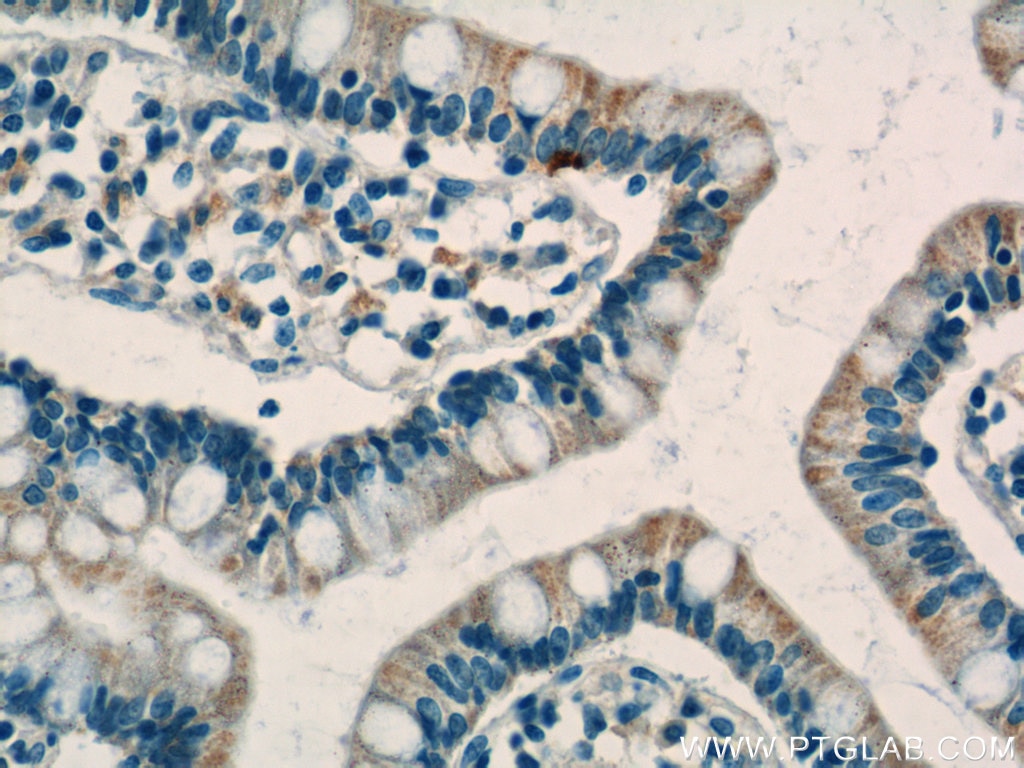 Immunohistochemistry (IHC) staining of human small intestine tissue using C1QTNF3 Polyclonal antibody (11414-1-AP)