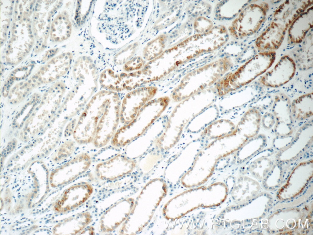 IHC staining of human kidney using 11414-1-AP