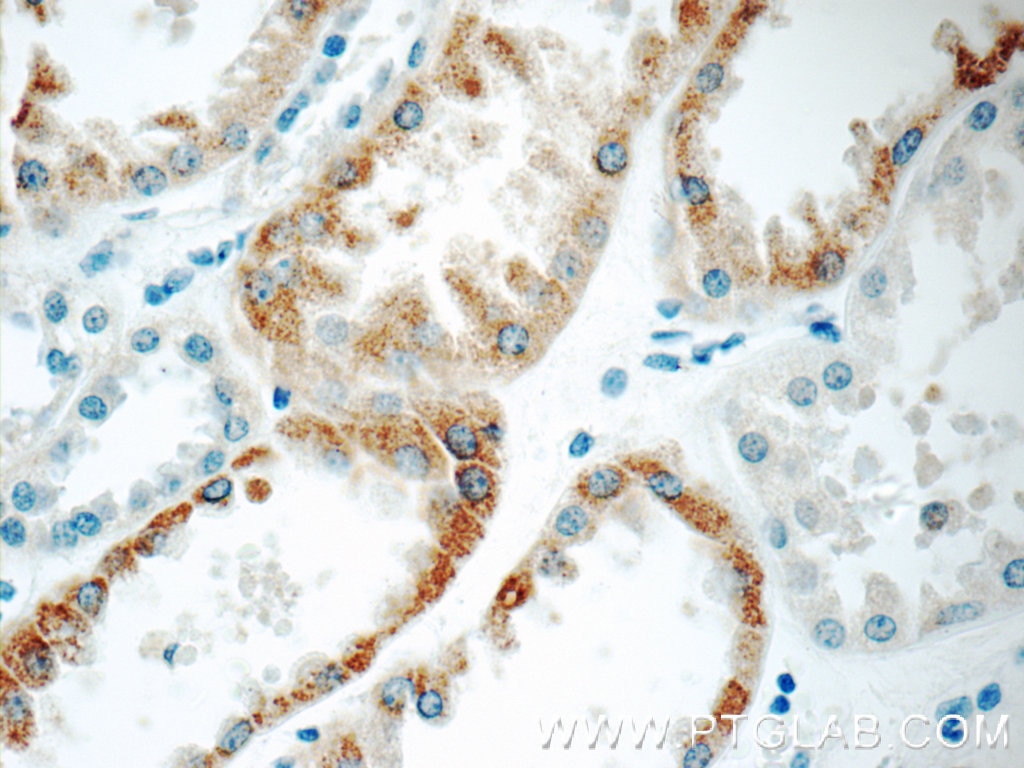 Immunohistochemistry (IHC) staining of human kidney tissue using C1QTNF3 Polyclonal antibody (11414-1-AP)