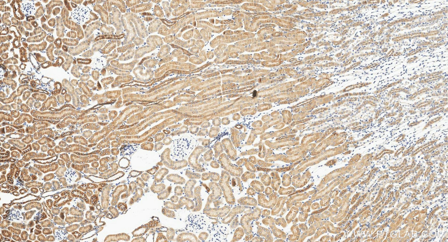 Immunohistochemistry (IHC) staining of mouse kidney tissue using C1QTNF3 Polyclonal antibody (11414-1-AP)