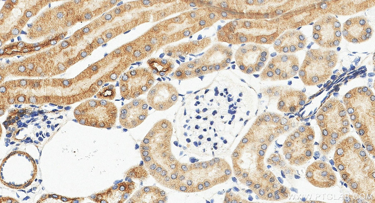 Immunohistochemistry (IHC) staining of mouse kidney tissue using C1QTNF3 Polyclonal antibody (11414-1-AP)