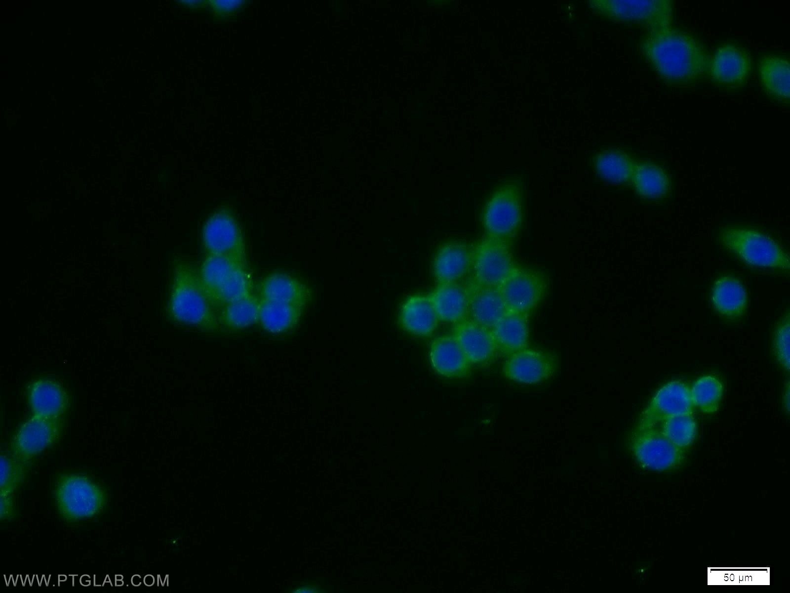 IF Staining of BxPC-3 using 14023-1-AP