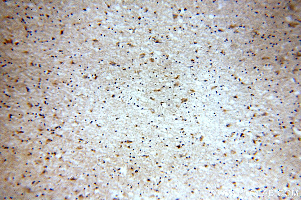 Immunohistochemistry (IHC) staining of human brain tissue using CTRP4 Polyclonal antibody (14023-1-AP)