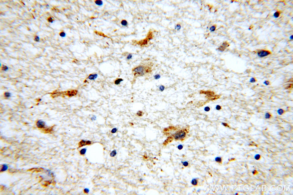 Immunohistochemistry (IHC) staining of human brain tissue using CTRP4 Polyclonal antibody (14023-1-AP)