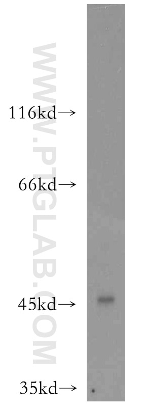 WB analysis of BxPC-3 using 14023-1-AP