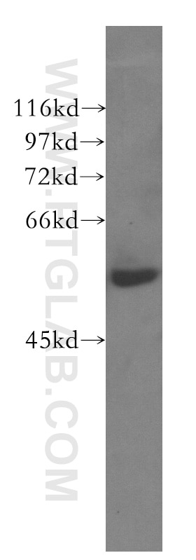 Western Blot (WB) analysis of HeLa cells using CTRP6 Polyclonal antibody (51030-1-AP)