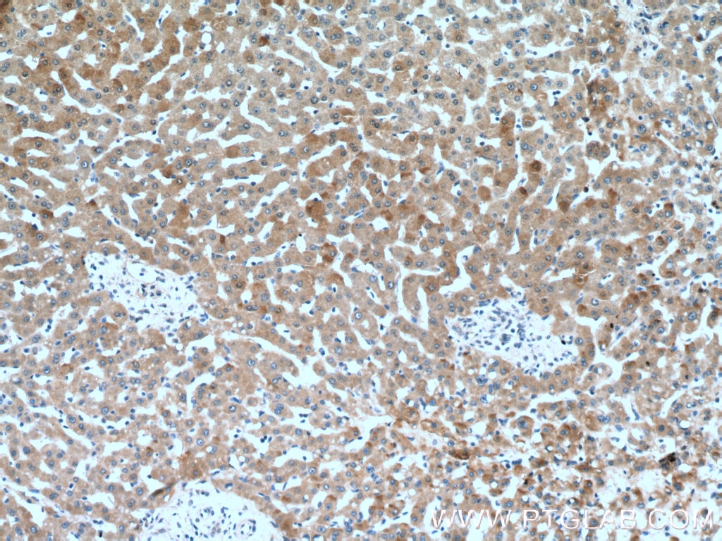 Immunohistochemistry (IHC) staining of human liver tissue using C1R Polyclonal antibody (17346-1-AP)