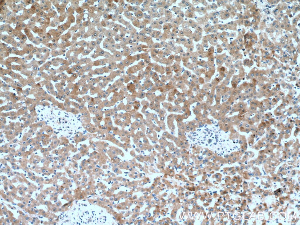 Immunohistochemistry (IHC) staining of human liver tissue using C1r Polyclonal antibody (17346-1-AP)