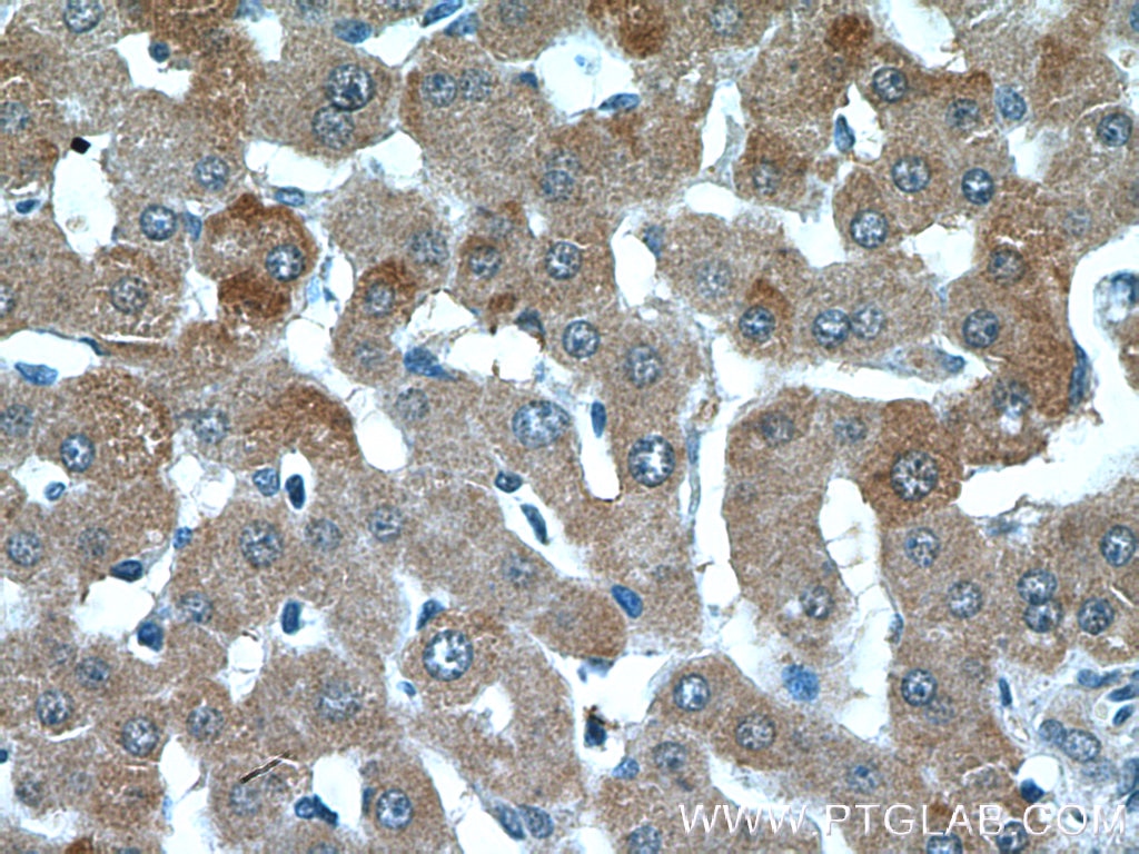 IHC staining of human liver using 17346-1-AP