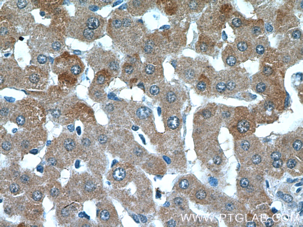 Immunohistochemistry (IHC) staining of human liver tissue using C1R Polyclonal antibody (17346-1-AP)