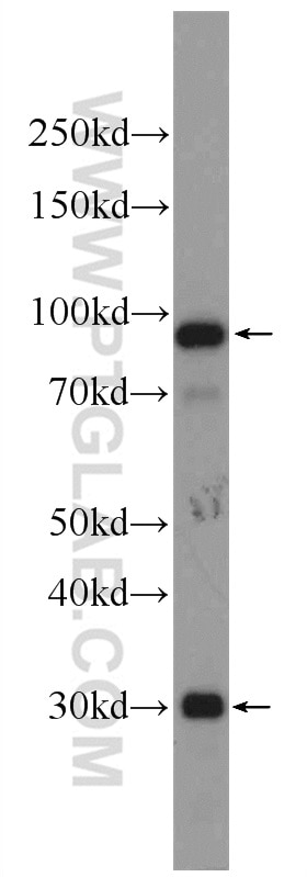 Western Blot (WB) analysis of human blood using C1R Polyclonal antibody (17346-1-AP)