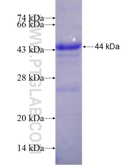 C1R fusion protein Ag11242 SDS-PAGE