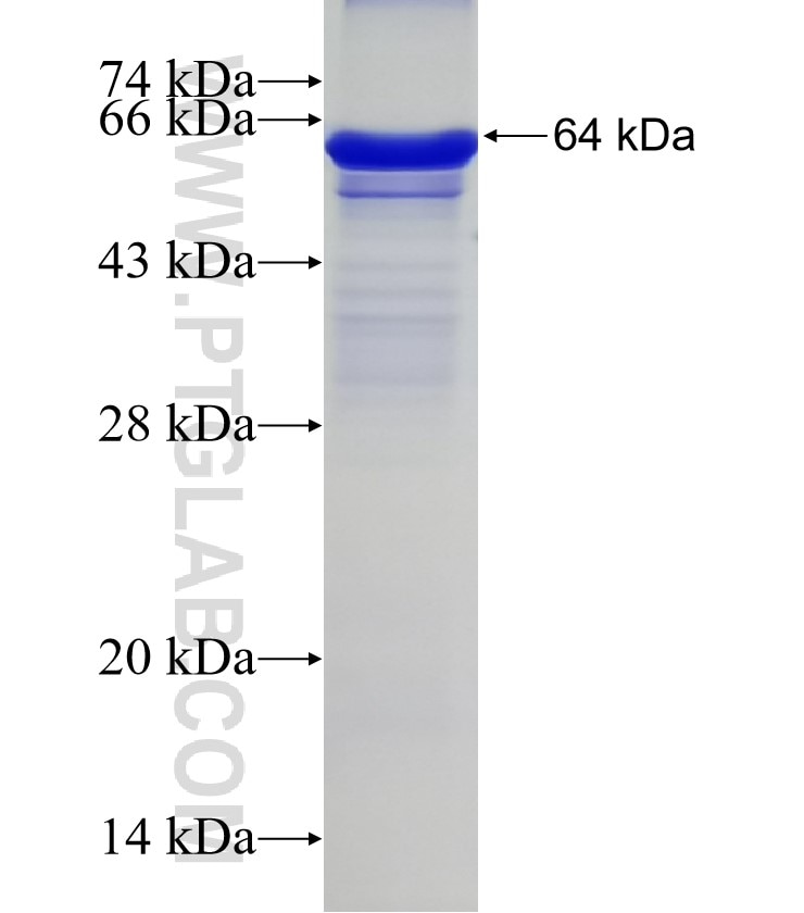 C1R fusion protein Ag11390 SDS-PAGE