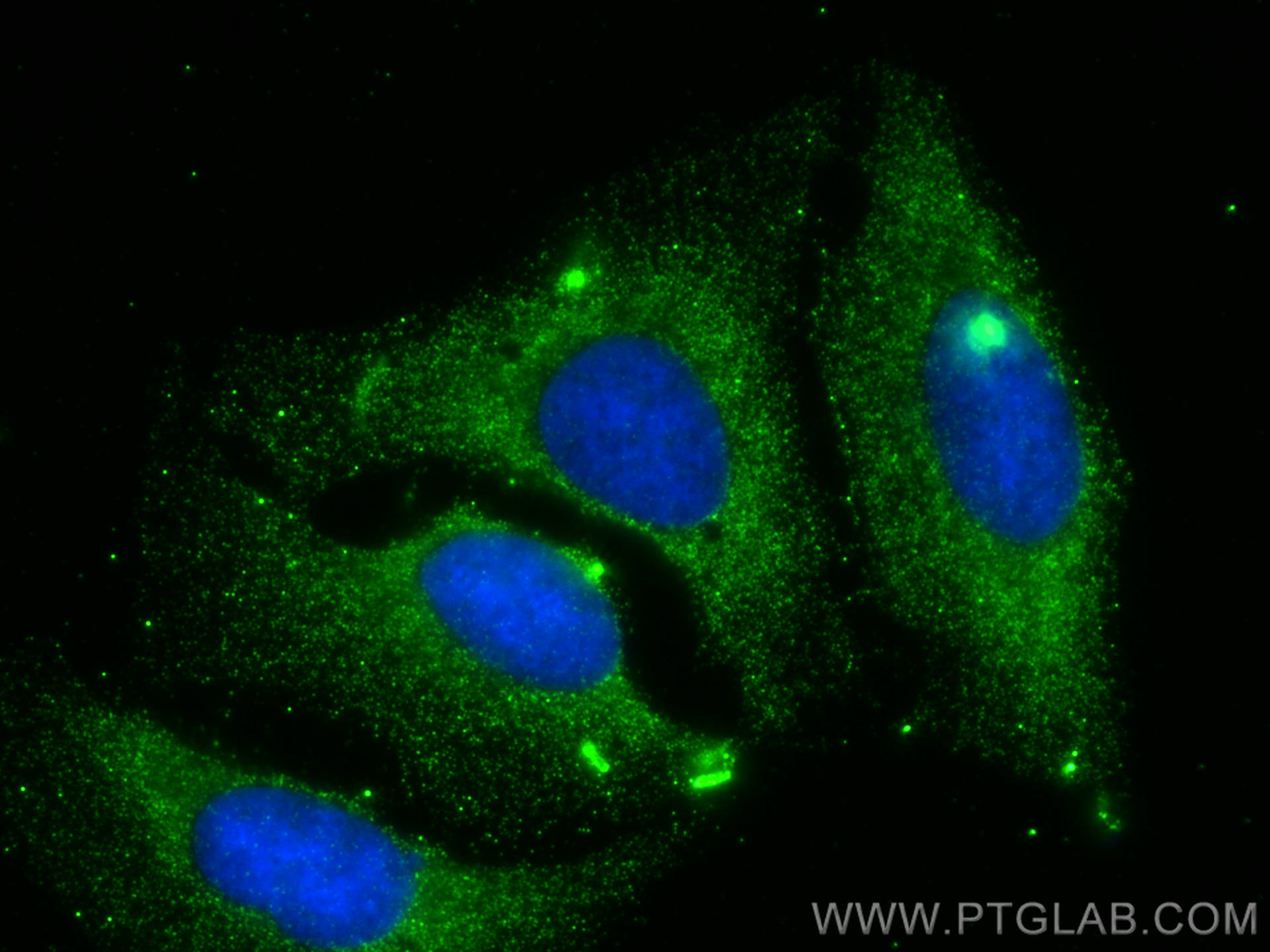 Immunofluorescence (IF) / fluorescent staining of U2OS cells using C1RL Polyclonal antibody (24820-1-AP)