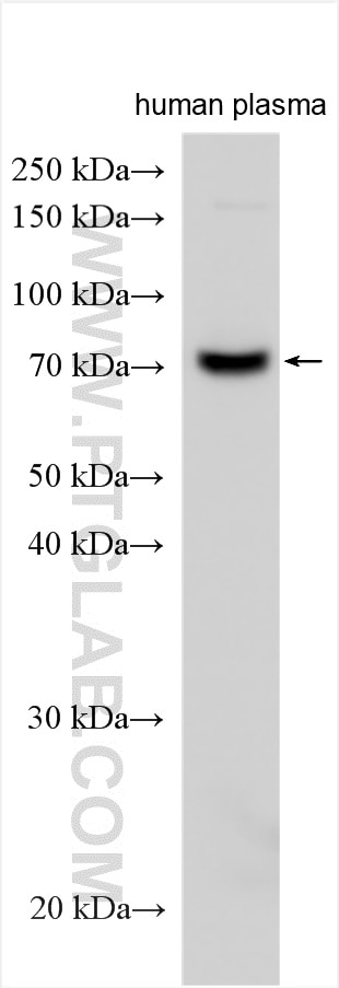 Western Blot (WB) analysis of various lysates using C1RL Polyclonal antibody (24820-1-AP)