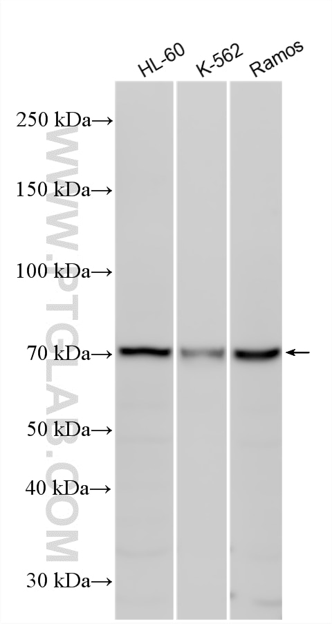 Various lysates were subjected to SDS PAGE followed by western blot with 24820-1-AP (C1RL antibody) at dilution of 1:1000 incubated at room temperature for 1.5 hours. Western Blot (WB) analysis of various lysates using C1RL Polyclonal antibody (24820-1-AP)