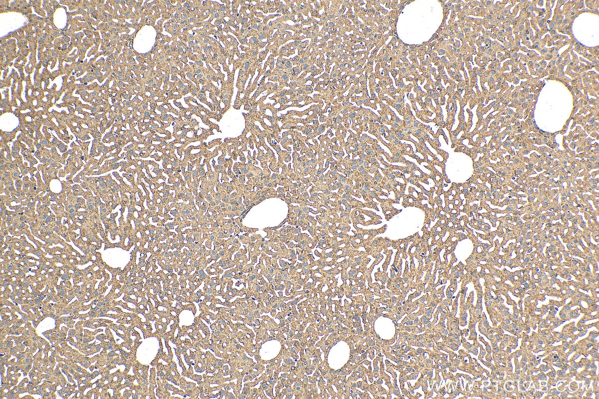 Immunohistochemistry (IHC) staining of mouse liver tissue using C1S Polyclonal antibody (14554-1-AP)