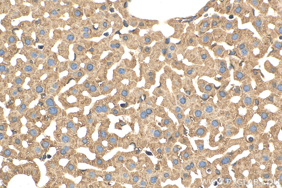 Immunohistochemistry (IHC) staining of mouse liver tissue using C1S Polyclonal antibody (14554-1-AP)