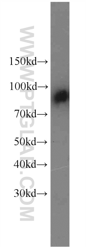 Western Blot (WB) analysis of human plasma using C1S Polyclonal antibody (14554-1-AP)