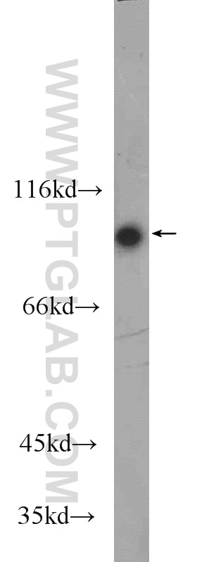 Western Blot (WB) analysis of human plasma using C1S Polyclonal antibody (14554-1-AP)