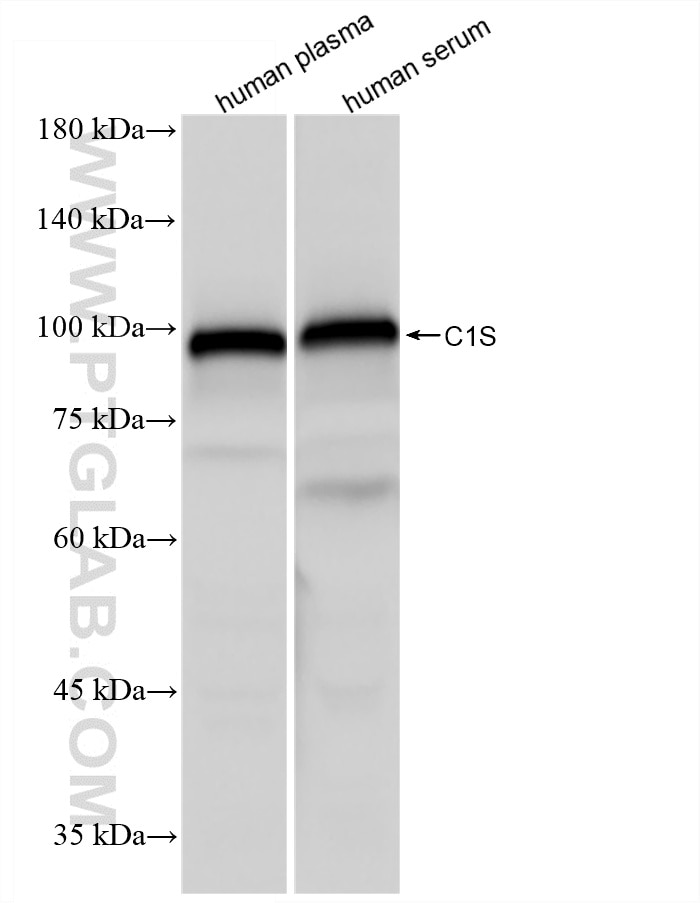 Western Blot (WB) analysis of various lysates using C1S Recombinant monoclonal antibody (85736-6-RR)