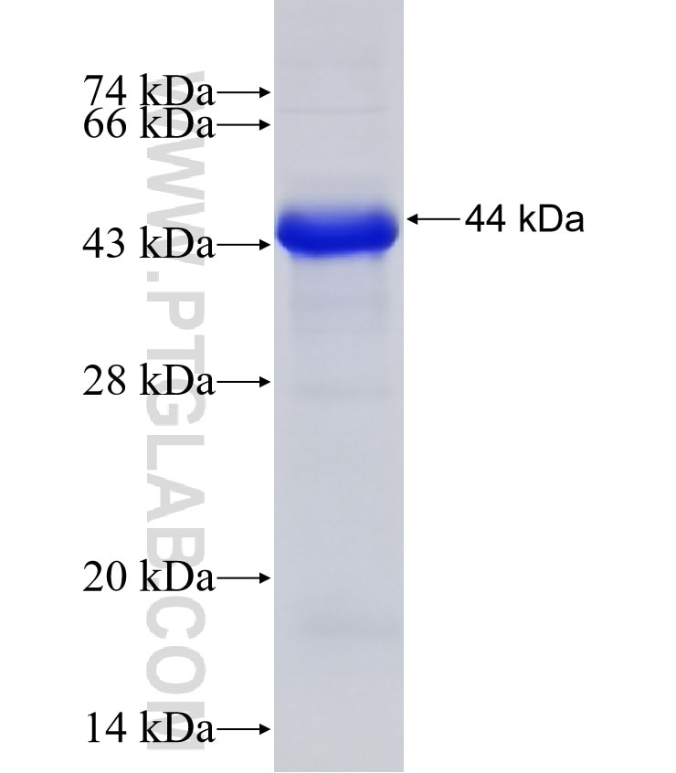 C1S fusion protein Ag6063 SDS-PAGE