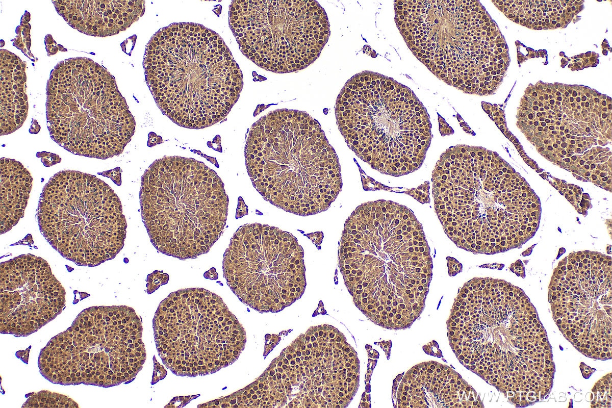 Immunohistochemistry (IHC) staining of mouse testis tissue using C1orf103 Polyclonal antibody (26115-1-AP)