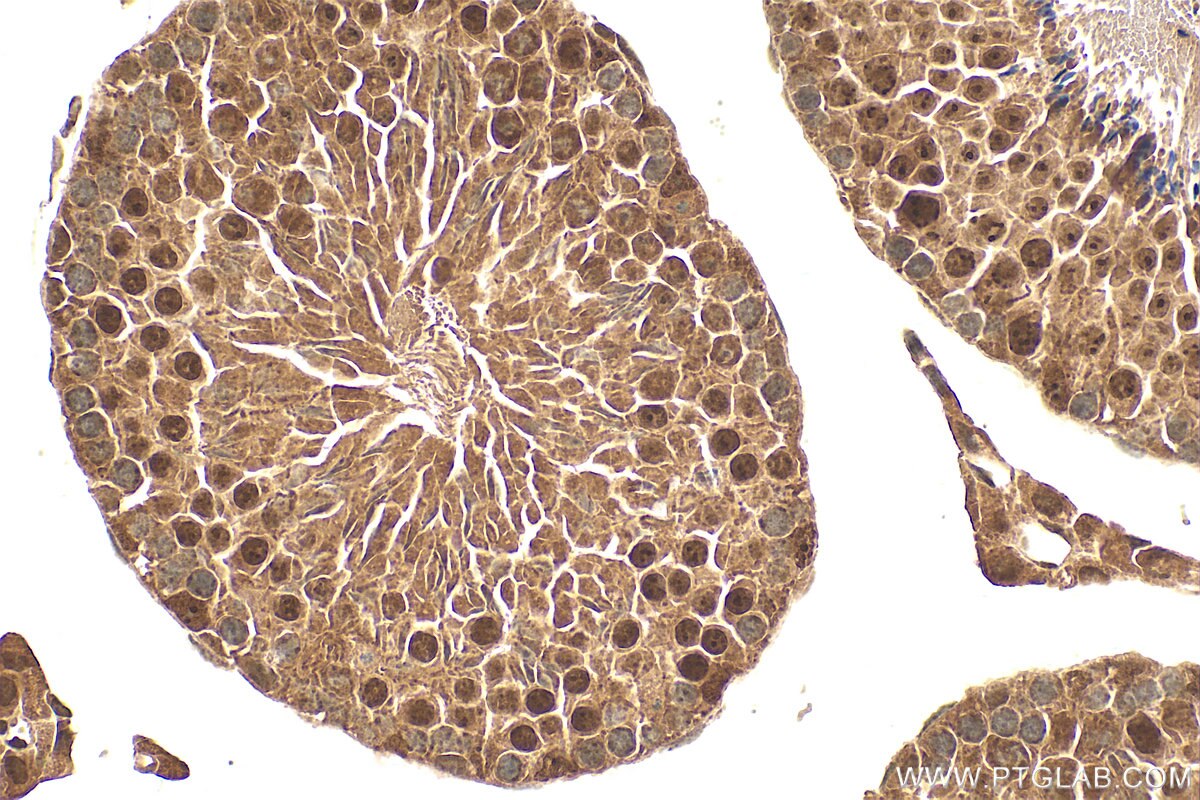 Immunohistochemistry (IHC) staining of mouse testis tissue using C1orf103 Polyclonal antibody (26115-1-AP)