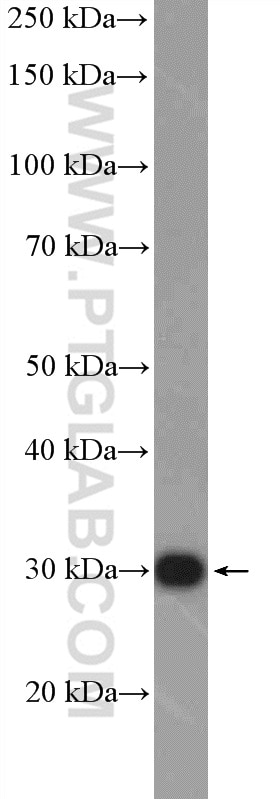 Western Blot (WB) analysis of mouse heart tissue using C1orf103 Polyclonal antibody (26115-1-AP)