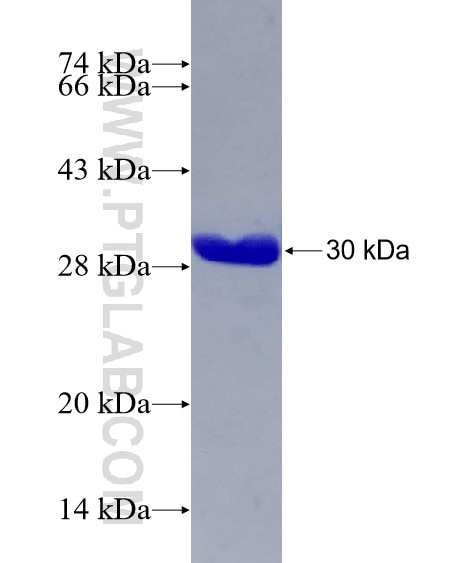 C1orf103 fusion protein Ag23494 SDS-PAGE