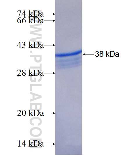 C1orf104 fusion protein Ag19536 SDS-PAGE