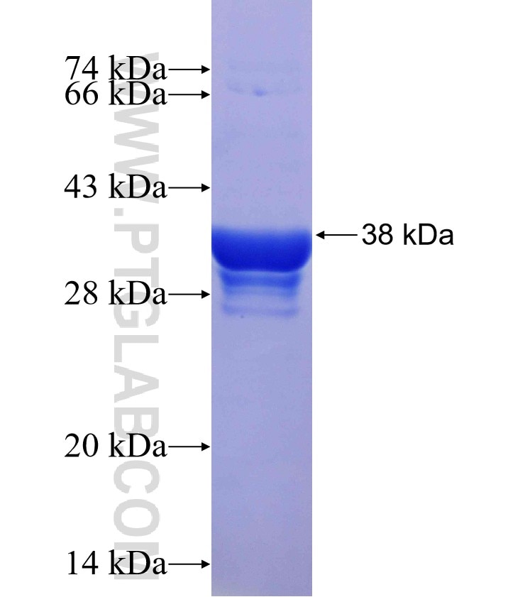 C1orf104 fusion protein Ag19536 SDS-PAGE