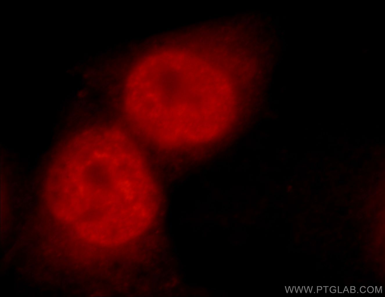 Immunofluorescence (IF) / fluorescent staining of HeLa cells using C1orf106 Polyclonal antibody (21506-1-AP)