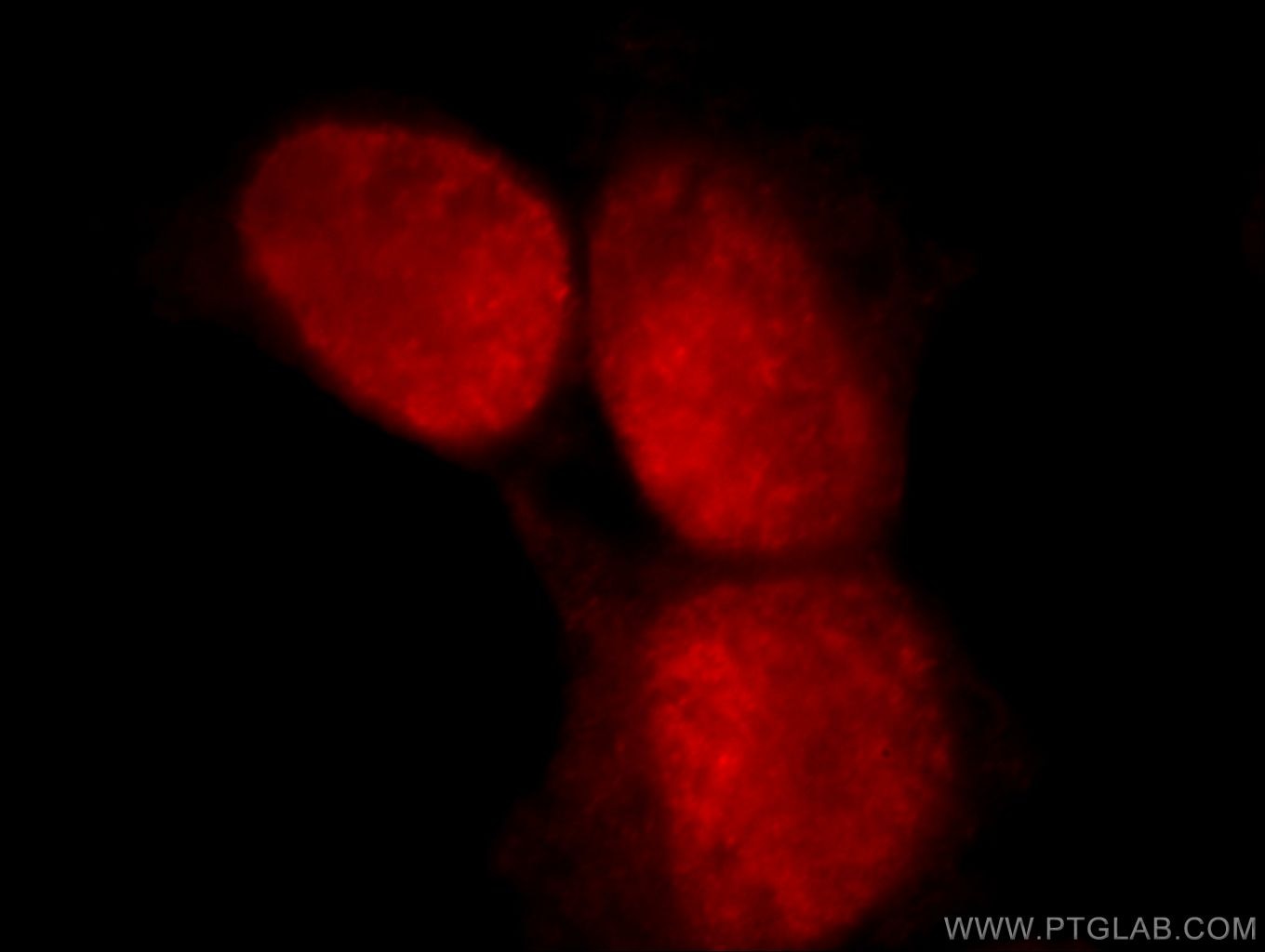 Immunofluorescence (IF) / fluorescent staining of HEK-293 cells using C1orf106 Polyclonal antibody (21506-1-AP)